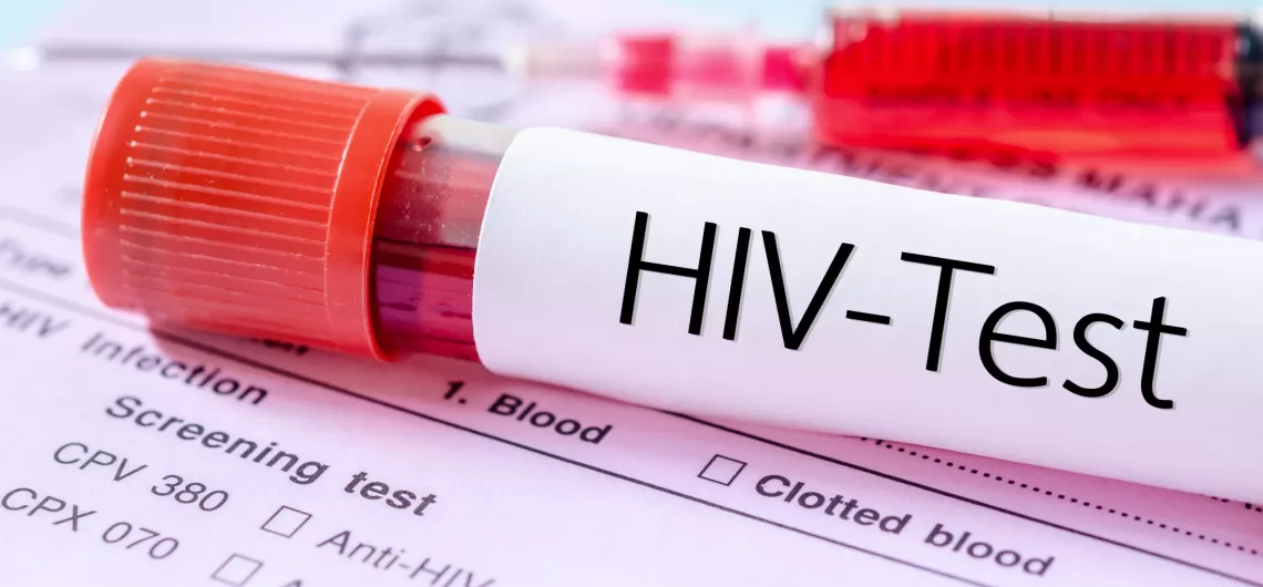Challeges Facing HIV and AIDs